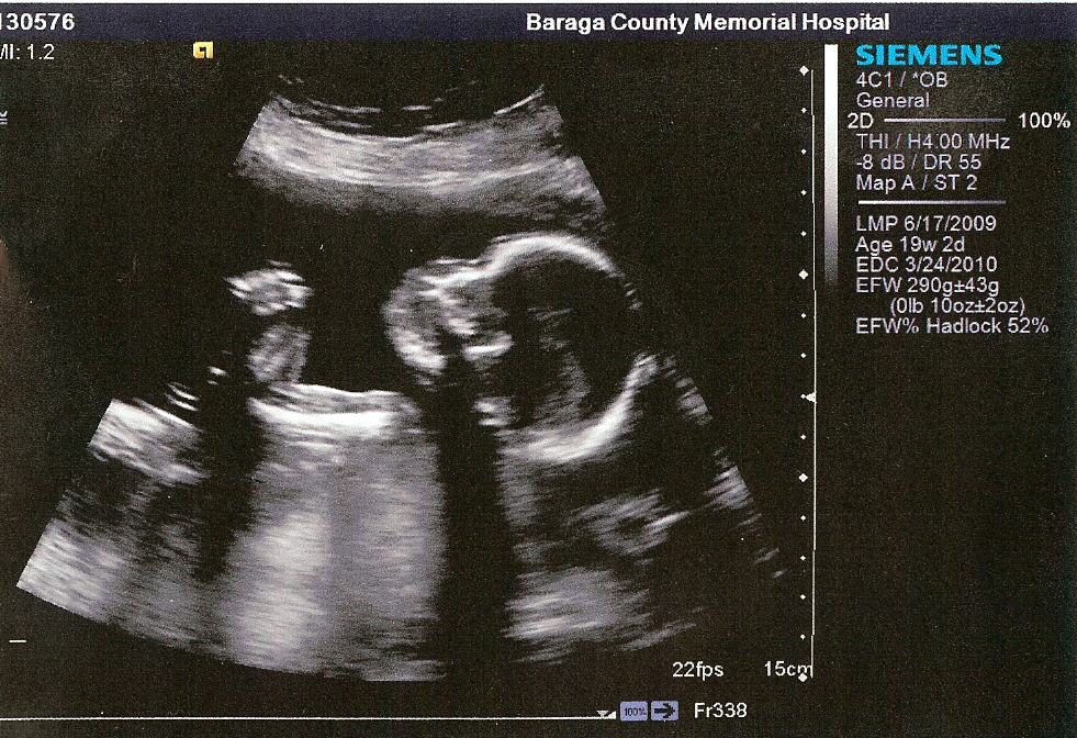 Ultrasound 19 weeks (October 30, 2009)